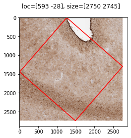 ../_images/examples_example2_normalize_cortex_2_1.png