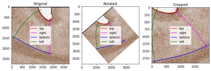 ../_images/examples_example2_normalize_cortex_2_2.png