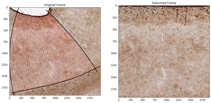 ../_images/examples_example2_normalize_cortex_4_0.png